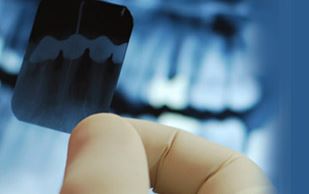 Oral Diagnoz ve Radyoloji